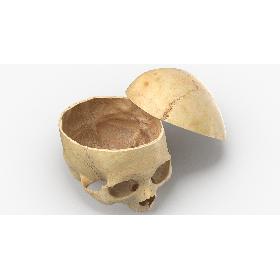 Real Human Skull Cranial 02 Cut With Piece Pose 02 model